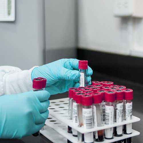 Buitenlandse werknemers die naar België komen moeten een negatieve coronatest hebben